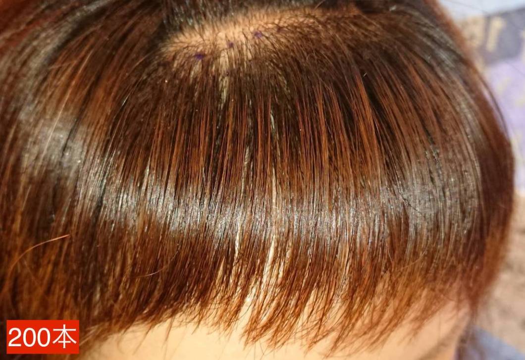 200本-2 Yoriko 前髪